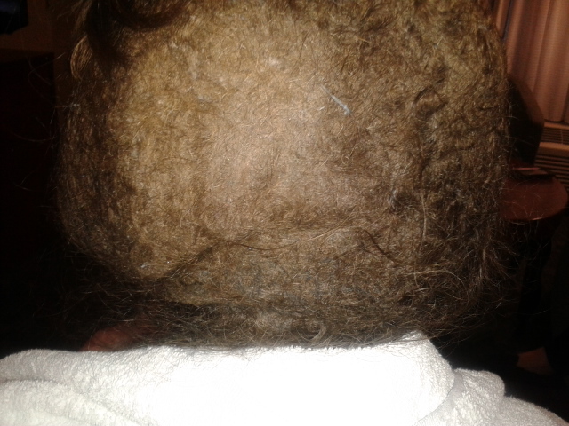 Over 9 Months Matted Hair to scalp