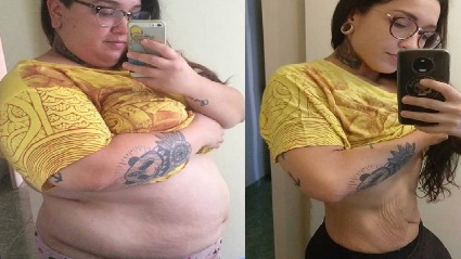 Before And After Kim Before And After Kim